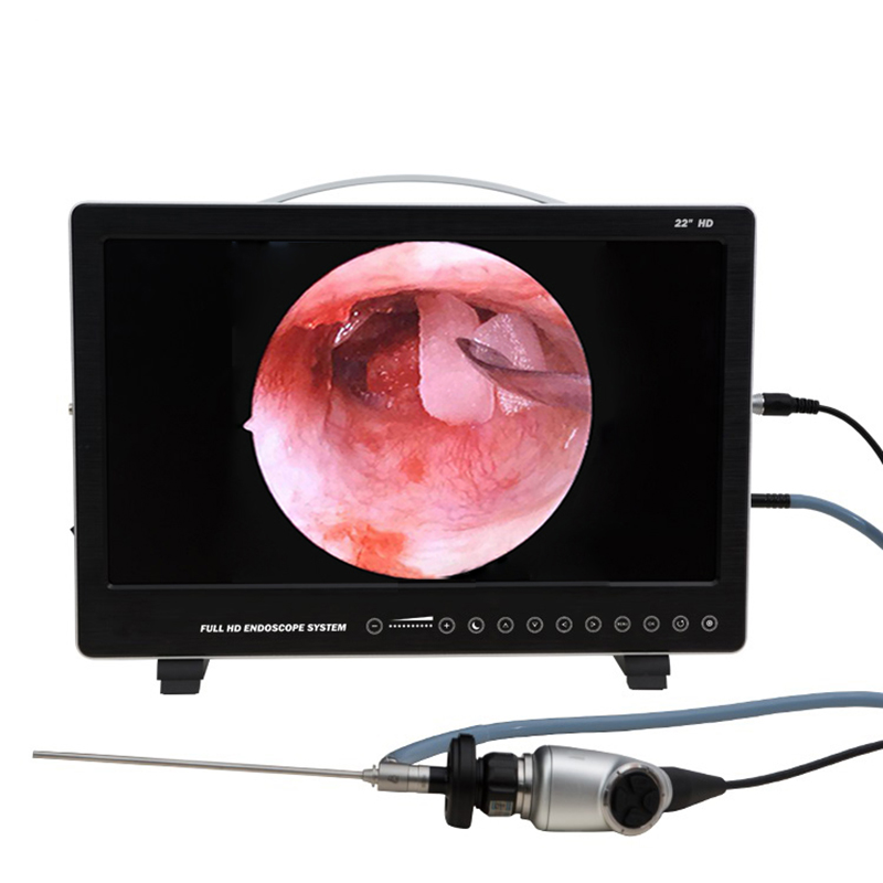 22 Inch Endoscoop Camera Syste - Laptop Accessories All In One recensie en prijs